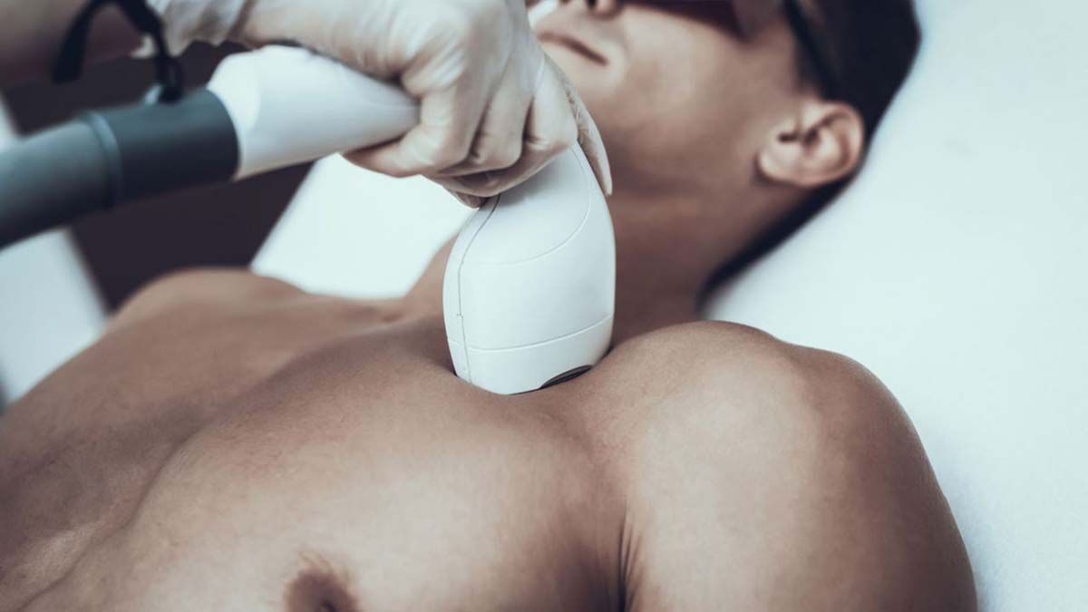 Cada vez más hombres se animan a este tipo de depilación que elimina el vello de forma permanente.
