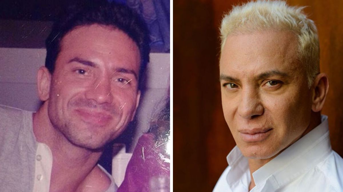 A lo largo de los años, Flavio Mendoza modificó su apariencia con distintos procedimientos estéticos. A lo largo de los años, Flavio Mendoza modificó su apariencia con distintos procedimientos estéticos. 