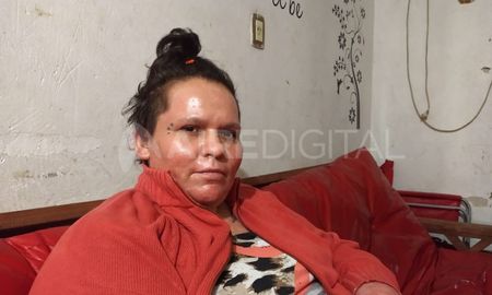 Tamara Quiroz, sobreviviente del intento de femicidio: Ninguna mujer merece que le causen daño. Hoy me amo y sé que no merezco ni merecí esto nunca, afirma. Tamara Quiroz, sobreviviente del intento de femicidio: Ninguna mujer merece que le causen daño. Hoy me amo y sé que no merezco ni merecí esto nunca, afirma.