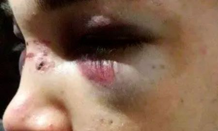 El&nbsp;viernes 20, alrededor de la 1.30 de la madrugada en inmediaciones de la rotonda ubicada frente al Hospital Centenario Natalio Burd, dos hermanos circulaban en sendas motocicletas cuando unos patrulleros comenzaron a perseguirlos porque tenían un aviso&nbsp;sobre motochorros en la zona.