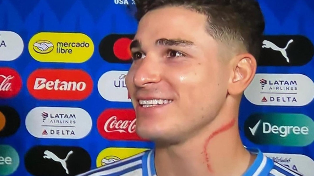 Copa América: qué le pasó en el cuello a Julián Álvarez