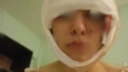 Trasladaron al Hospital Cullen a la joven de 15 años atacada salvajemente en San Cristóbal