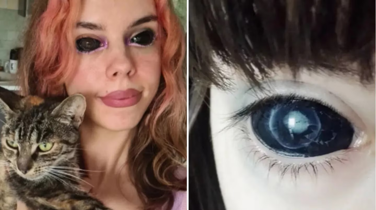 A pesar de haberse sometido a varias cirugías, Aleksandra Sadowska no pudo recuperar la vista.