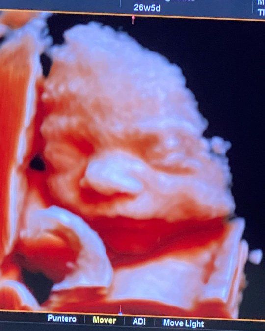 Jacobella, la hija de Magalí Mora.