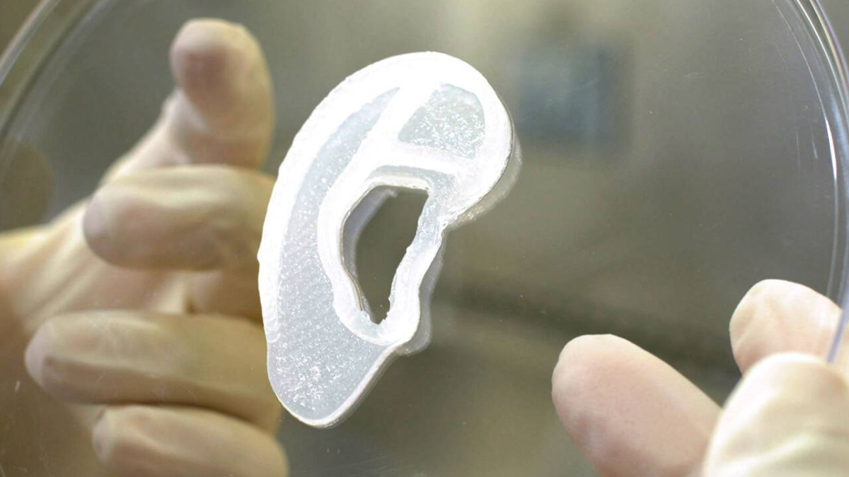 Tuvo que llevar su oreja implantada en su pie durante meses.