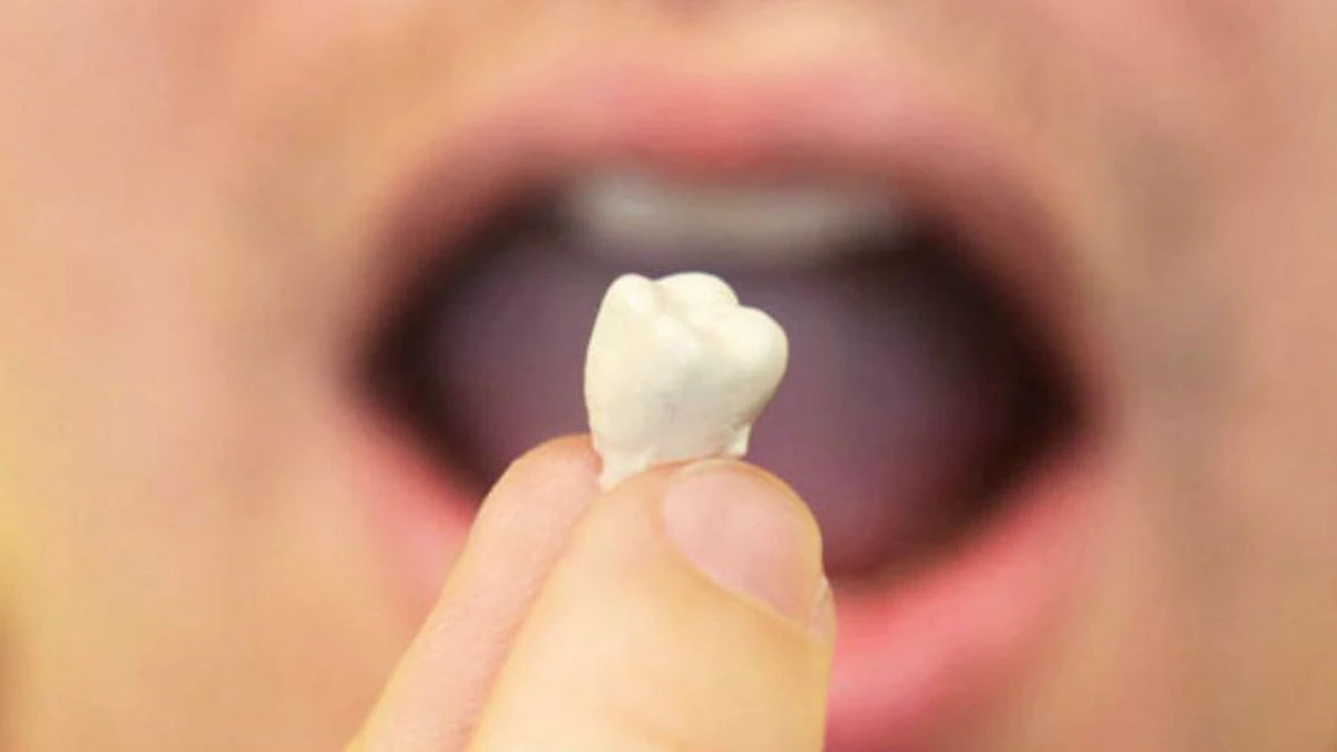 Variantes de soñar con dientes caídos.