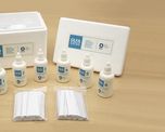 El kit denominado Olfatest cuenta con seis goteros de esencias diferentes. El kit denominado Olfatest cuenta con seis goteros de esencias diferentes.