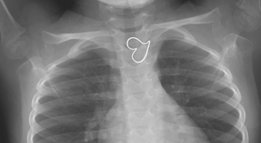 corazon de oro.jpg