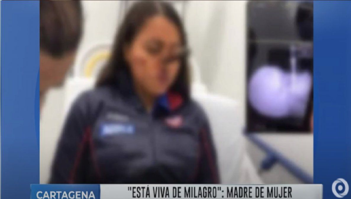 Le robaron y le clavaron un cuchillo en la cara