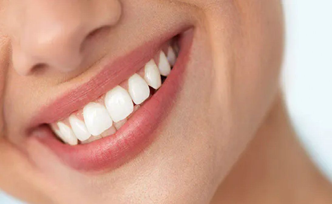 Remedios caseros para eliminar el sarro de los dientes