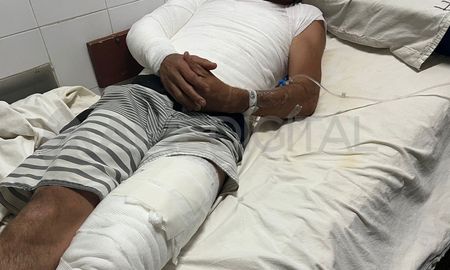 El paciente ingresó al Hospital Cullen con quemaduras en distintas partes de su cuerpo. El paciente ingresó al Hospital Cullen con quemaduras en distintas partes de su cuerpo.
