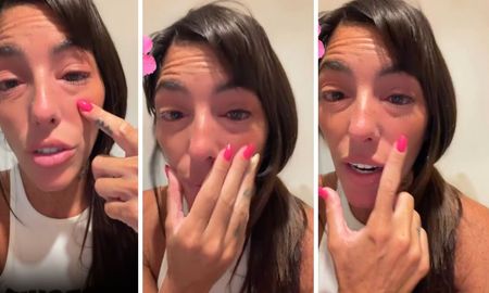 Catalina Gorostidi mostró una fuerte reacción alérgica en el rostro. Catalina Gorostidi mostró una fuerte reacción alérgica en el rostro.