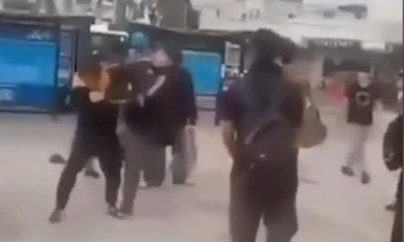 Brutal ataque a un adolescente de 13 años: le pegaron con un martillo por querer evitar un robo Brutal ataque a un adolescente de 13 años: le pegaron con un martillo por querer evitar un robo