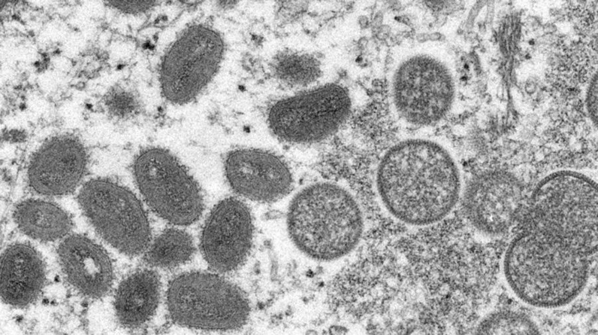 La OMS ha registrado m&aacute;s de 1.000 casos de viruela del mono en una treintena de pa&iacute;ses.