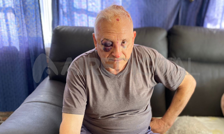 El hombre de 67 años sufrió una violenta entradera el jueves por la noche en su casa ubicada en el km 19 de Arroyo Leyes. El hombre de 67 años sufrió una violenta entradera el jueves por la noche en su casa ubicada en el km 19 de Arroyo Leyes.