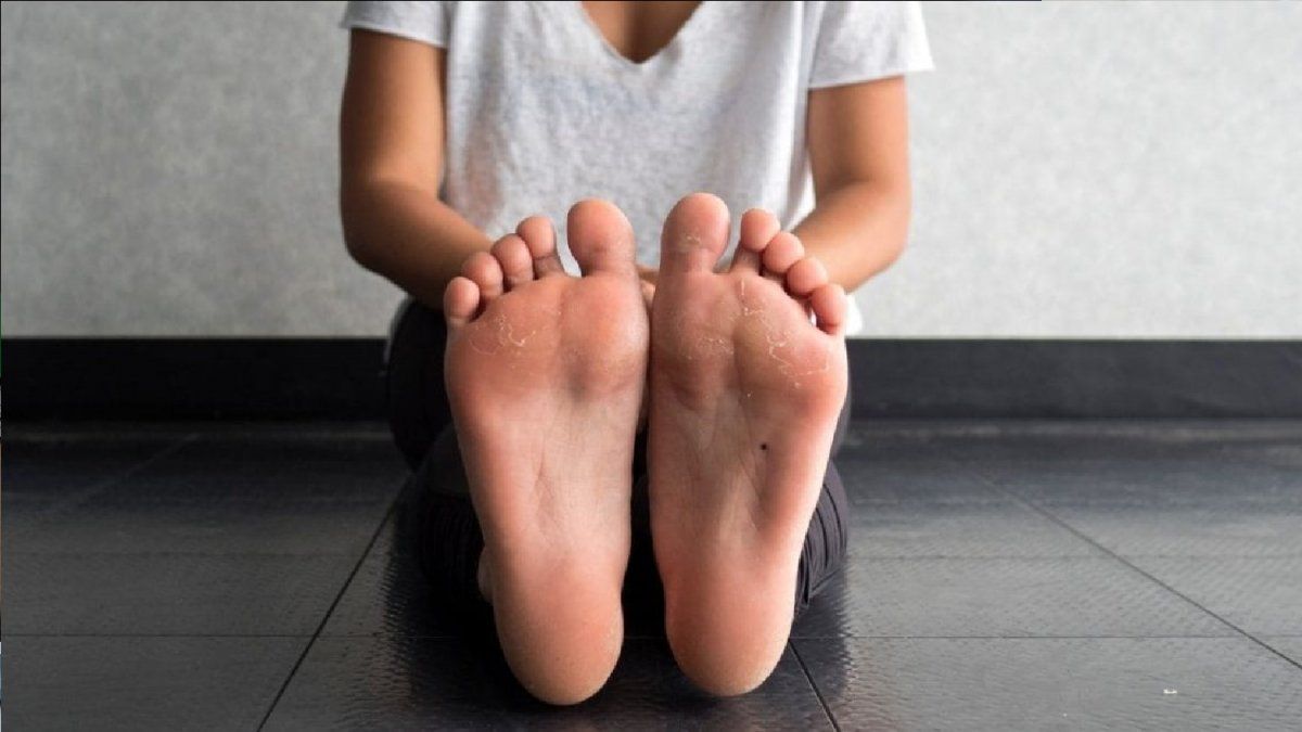 El mejor ingrediente natural para eliminar los callos de los pies