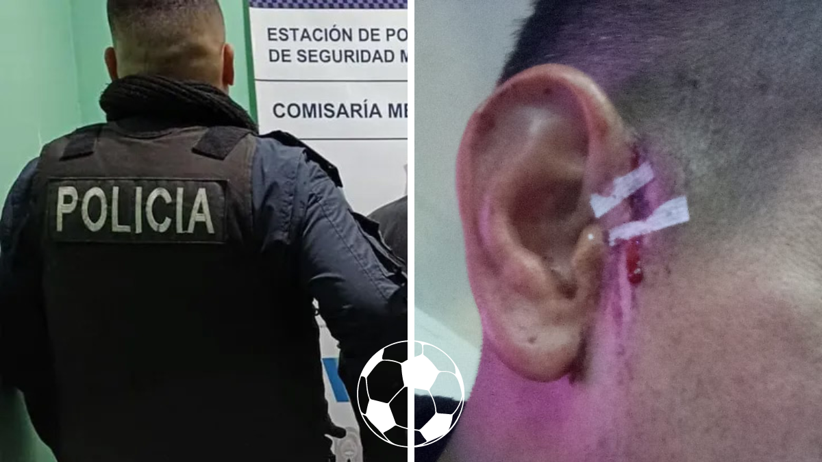Futbolista atacado con un cuchillo fue a hacer la denuncia