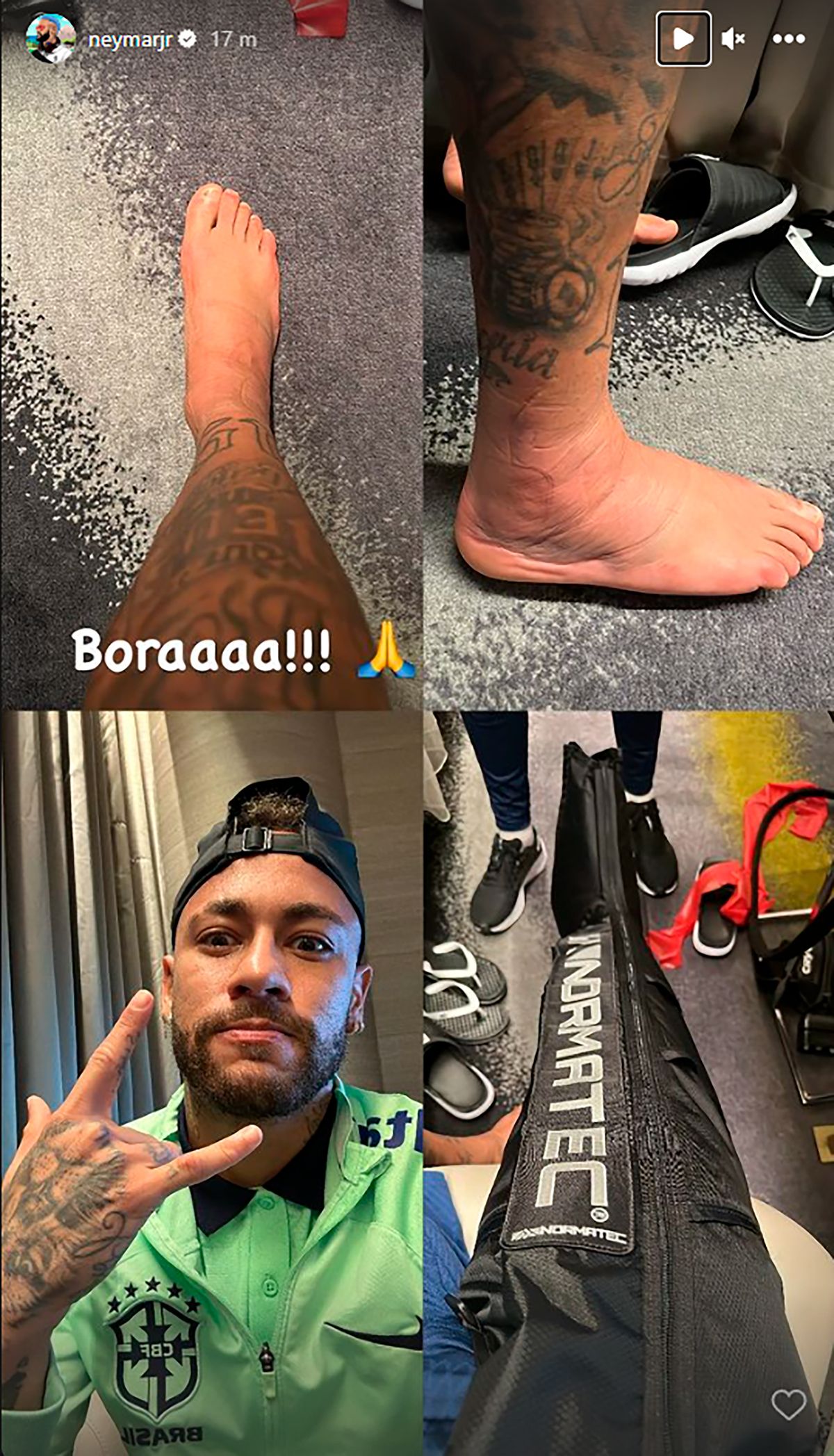 Las fotos en Instagram de Neymar que muestran cómo se está tratando para curarse rápido de su lesión en el tobillo.