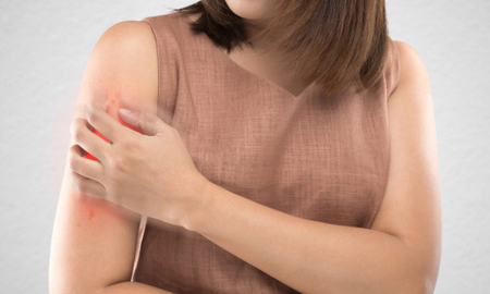 ¿Tenés granitos en el brazo?: por qué salen y cómo desaparecerlos ¿Tenés granitos en el brazo?: por qué salen y cómo desaparecerlos