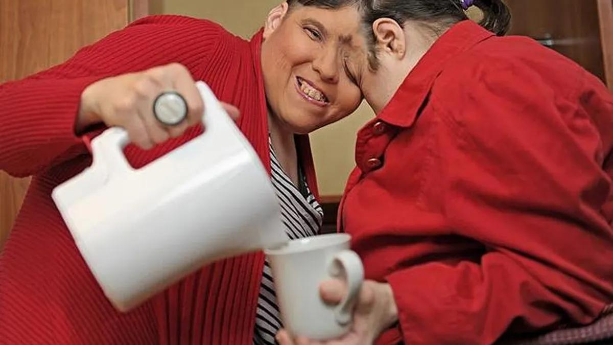 Quiénes fueron Lori y George Schappell, los gemelos siameses más longevos del mundo. Quiénes fueron Lori y George Schappell, los gemelos siameses más longevos del mundo.