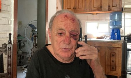 Horacio, la víctima del asalto, habló con AIRE y contó lo ocurrido el miércoles por la mañana. Horacio, la víctima del asalto, habló con AIRE y contó lo ocurrido el miércoles por la mañana.