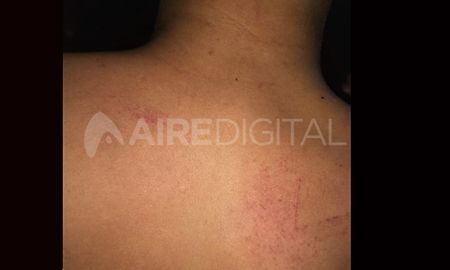 Me apoyó un arma en la cabeza y me pega un tiro. Ahí me sacó por la ventana que da a un patio, ahí me tuvo un rato pegándome con la pistola en la cabeza y por otras partes del cuerpo, relató el menor. Me apoyó un arma en la cabeza y me pega un tiro. Ahí me sacó por la ventana que da a un patio, ahí me tuvo un rato pegándome con la pistola en la cabeza y por otras partes del cuerpo, relató el menor.