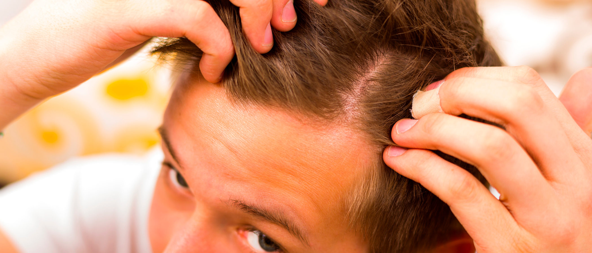 Cómo cuidar el cabello en adolescentes: los problemas más comunes y sus soluciones