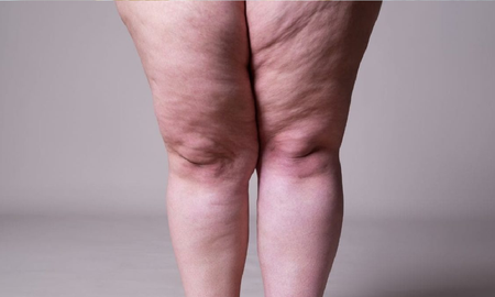 tips para adelgazar la grasa de las piernas de forma saludable tips para adelgazar la grasa de las piernas de forma saludable