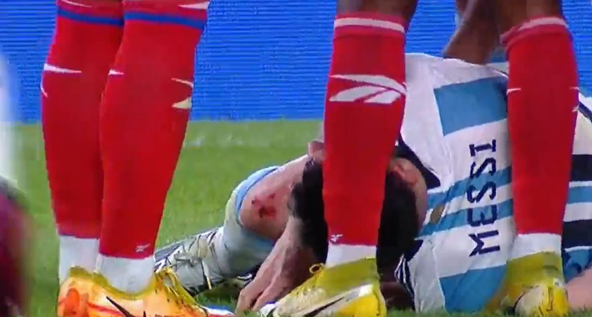 Lionel Messi recibió una dura patada durante el amistoso de Argentina con Panamá