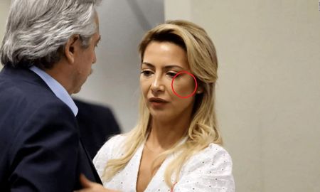 En Mañanísima, Mercedes Ninci reveló que Fabiola se maquillaba para disimular los golpes en la cara que, supuestamente, le propinaba Alberto. En Mañanísima, Mercedes Ninci reveló que Fabiola se maquillaba para disimular los golpes en la cara que, supuestamente, le propinaba Alberto.