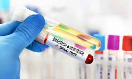 Proponen que funcionarios de los tres poderes se realicen exámenes toxicológicos para saber si consumen drogas Proponen que funcionarios de los tres poderes se realicen exámenes toxicológicos para saber si consumen drogas