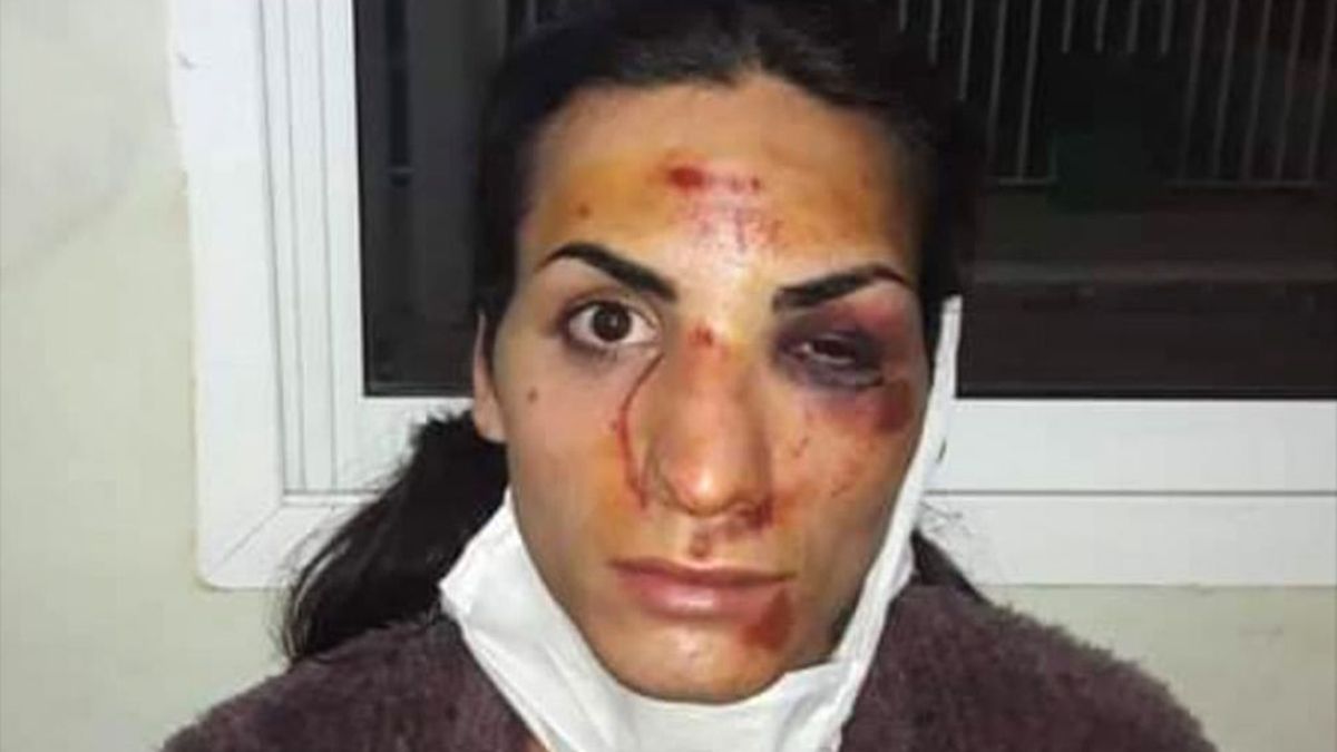 Agredieron a patadas a una chica trans en San Pedro