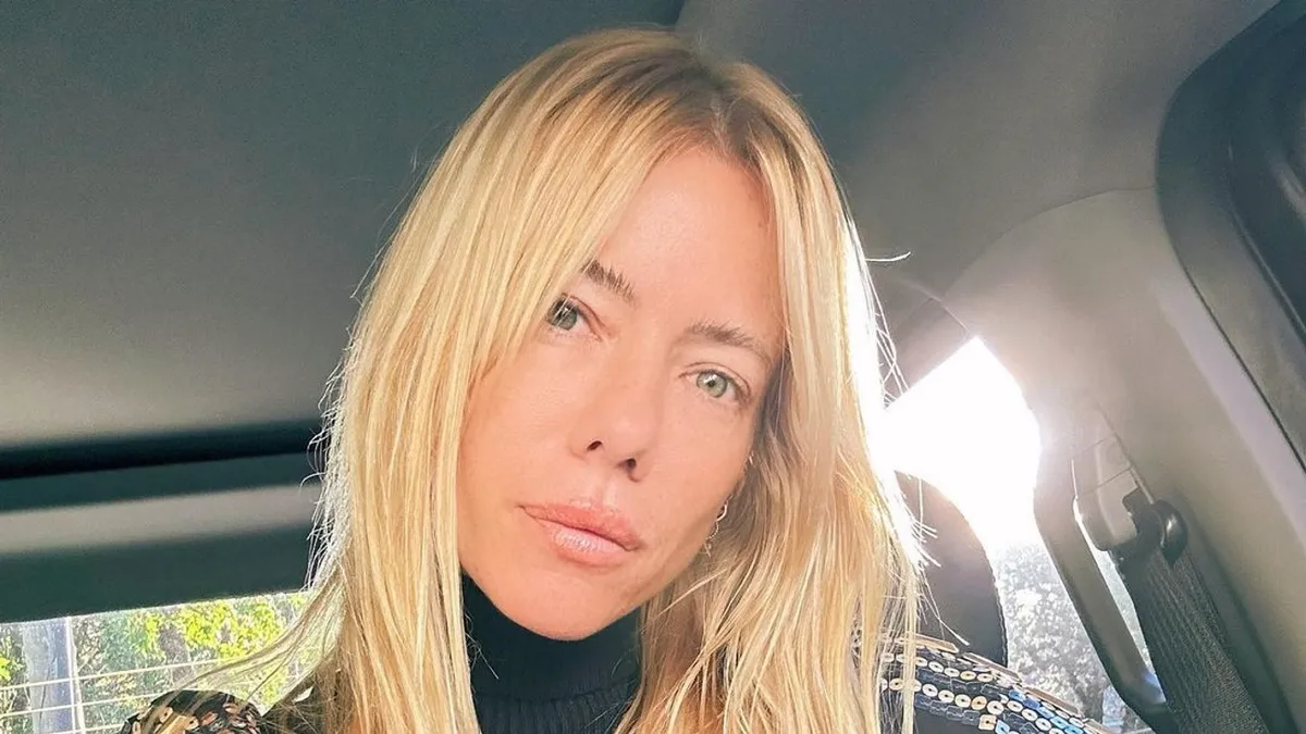 Nicole Neumann se sometió a un procedimiento estético y mostró cómo quedó: Carita de ángel