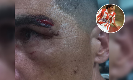 Agredieron al Memo Torres y a su mujer en plena tribuna de Unión: Me hicieron 3 puntos. Agredieron al Memo Torres y a su mujer en plena tribuna de Unión: Me hicieron 3 puntos.