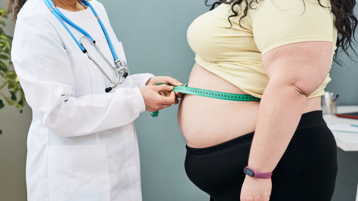 La obesidad de grado III como una patología compleja que trasciende la simple voluntad.