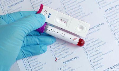 En Argentina, más de 300.000 personas tienen hepatitis C pero el 70% lo ignora. En Argentina, más de 300.000 personas tienen hepatitis C pero el 70% lo ignora.