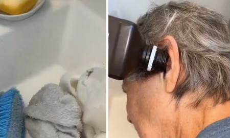 Fue al médico porque le dolía el oído y lo que le encontraron dejó a todos impactado. Fue al médico porque le dolía el oído y lo que le encontraron dejó a todos impactado.