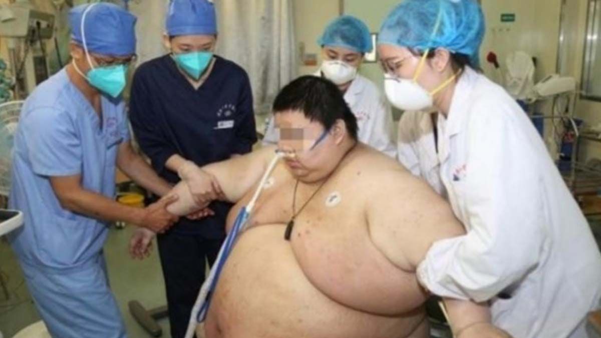 Engordó 100 kilos tras cinco meses de cuarentena