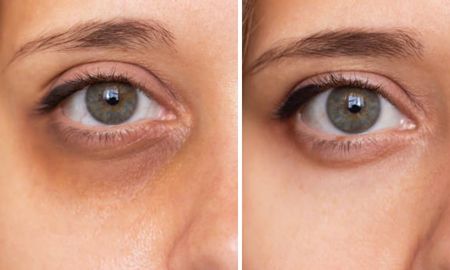Una especialista en estética compartió una rutina simple con un solo ingrediente vegetal Una especialista en estética compartió una rutina simple con un solo ingrediente vegetal