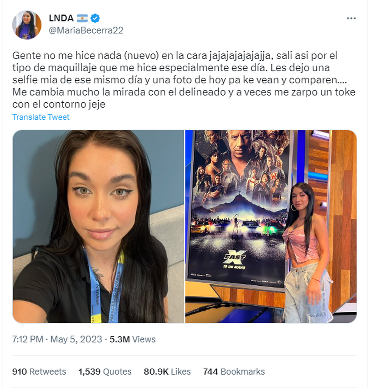 María Becerra negó haberse "tocado" la cara.