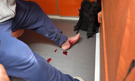Así quedó el pie de un camarógrafo televisivo luego de ser herido con una bomba de estruendo en el partido de Atlético de Rafaela y Brown de Adrogué. Así quedó el pie de un camarógrafo televisivo luego de ser herido con una bomba de estruendo en el partido de Atlético de Rafaela y Brown de Adrogué.