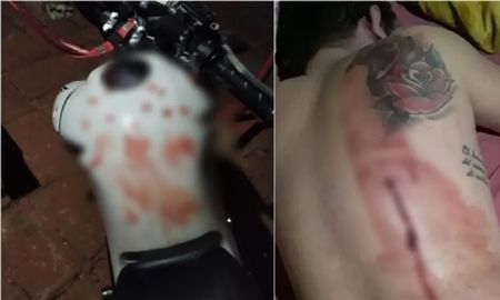 Hacían ruido con el escape de una moto y un vecino los corrió a tiros Hacían ruido con el escape de una moto y un vecino los corrió a tiros