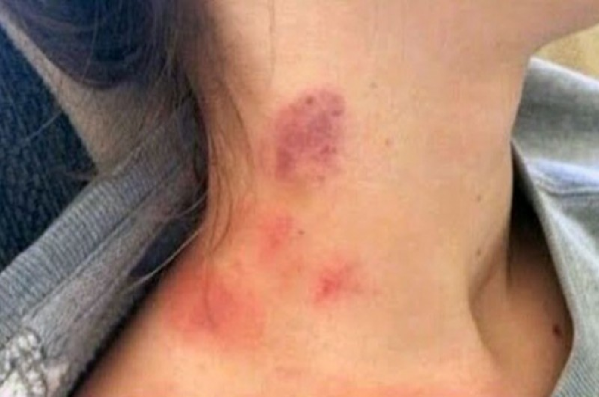 La niña de 9 años era abusada por su padrastro