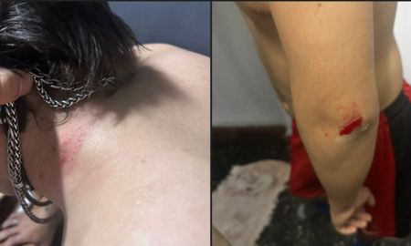 El adolescente recibió asistencia médica y, según el testimonio familiar, no sufrió heridas de gravedad. El adolescente recibió asistencia médica y, según el testimonio familiar, no sufrió heridas de gravedad.