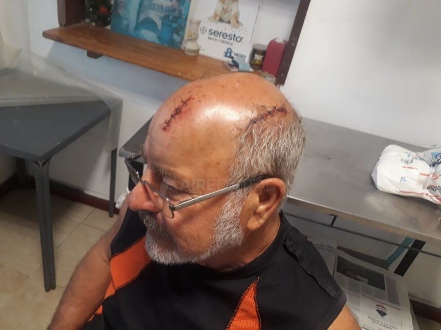 Se despertó con delincuentes en su casa y lo golpearon brutalmente para robarle
