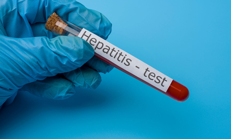 Día mundial contra la hepatitis: ¿por qué se conmemora el 28 de julio? Día mundial contra la hepatitis: ¿por qué se conmemora el 28 de julio?