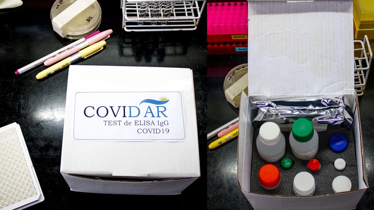 Así funciona el test argentino de coronavirus que estará disponible la próxima semana en el país