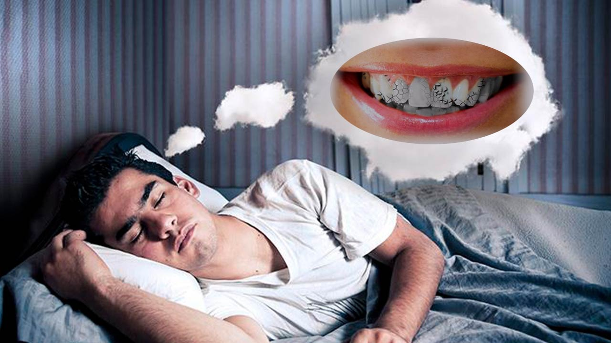 Un estudio detectó que el 39% de los encuestados experimentaron al menos una vez en su vida este tipo de anomalía.Que significa soñar que se te caen los dientes