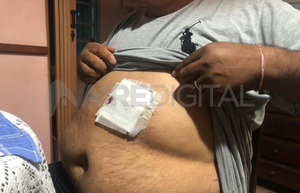 El remisero tiene una herida corto punzante en la panza. Fue hospitalizado y está fuera de peligro.