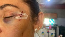 altText(Detienen a dos mujeres por el brutal ataque a una vecina en San José del Rincón)}